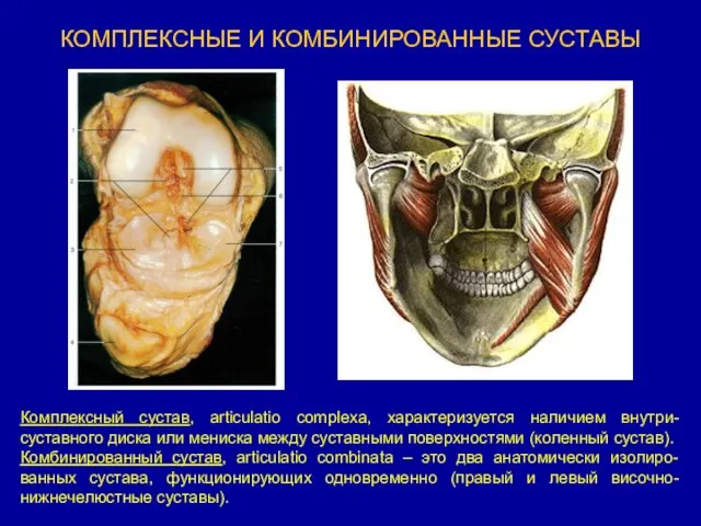 КОМПЛЕКСНЫЕ И КОМБИНИРОВАННЫЕ СУСТАВЫ Комплексный сустав, articulatio complexa, характеризуется наличием