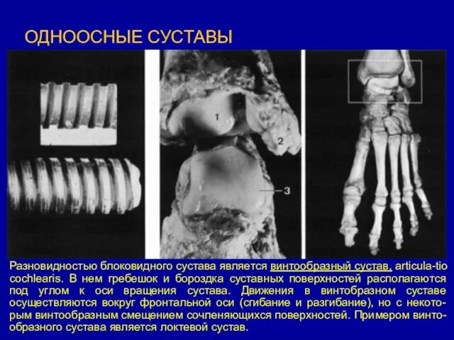 ОДНООСНЫЕ СУСТАВЫ Разновидностью блоковидного сустава является винтообразный сустав, articula-tio cochlearis.