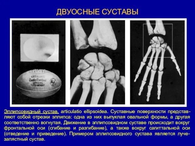 ДВУОСНЫЕ СУСТАВЫ Эллипсовидный сустав, articulatio ellipsoidea. Суставные поверхности представ-ляют собой