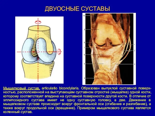 ДВУОСНЫЕ СУСТАВЫ Мыщелковый сустав, articulatio bicondylaris. Образован выпуклой суставной поверх-ностью,