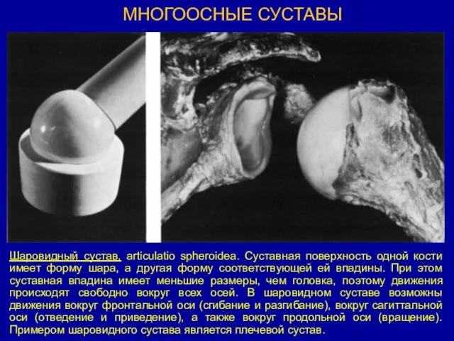 МНОГООСНЫЕ СУСТАВЫ Шаровидный сустав, articulatio spheroidea. Суставная поверхность одной кости