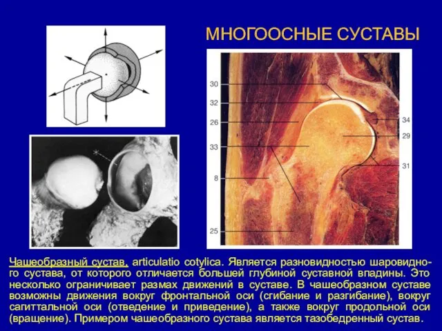 МНОГООСНЫЕ СУСТАВЫ Чашеобразный сустав, articulatio cotylica. Является разновидностью шаровидно-го сустава,