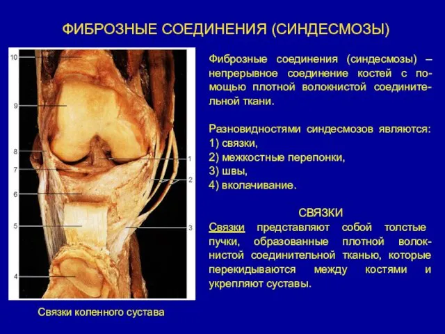 ФИБРОЗНЫЕ СОЕДИНЕНИЯ (СИНДЕСМОЗЫ) Фиброзные соединения (синдесмозы) –непрерывное соединение костей с