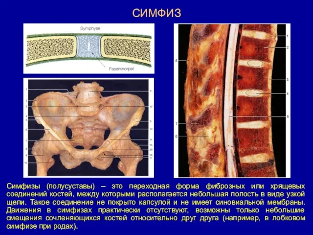 СИМФИЗ Симфизы (полусуставы) – это переходная форма фиброзных или хрящевых