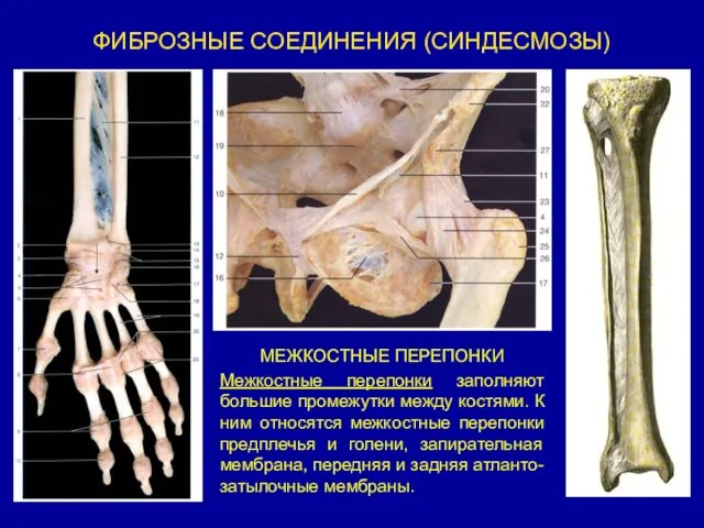 ФИБРОЗНЫЕ СОЕДИНЕНИЯ (СИНДЕСМОЗЫ) МЕЖКОСТНЫЕ ПЕРЕПОНКИ Межкостные перепонки заполняют большие промежутки