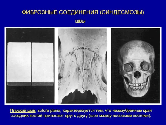 Плоский шов, sutura plana, характеризуется тем, что незазубренные края соседних