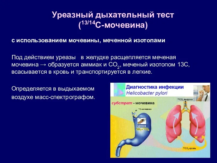 с использованием мочевины, меченной изотопами Под действием уреазы в желудке