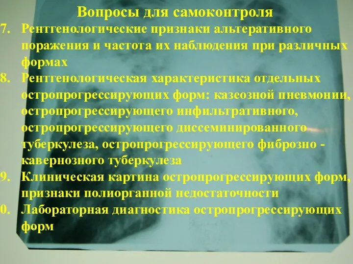 Рентгенологические признаки альтеративного поражения и частота их наблюдения при различных