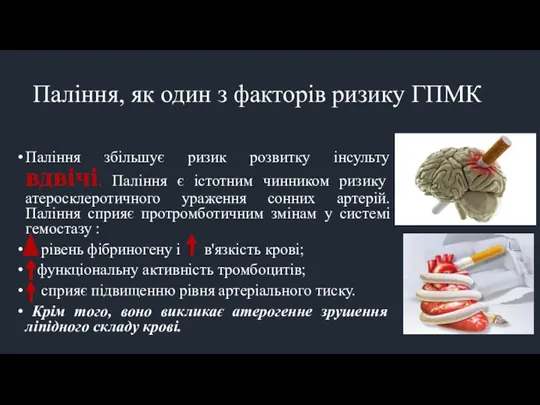 Паління, як один з факторів ризику ГПМК Паління збільшує ризик