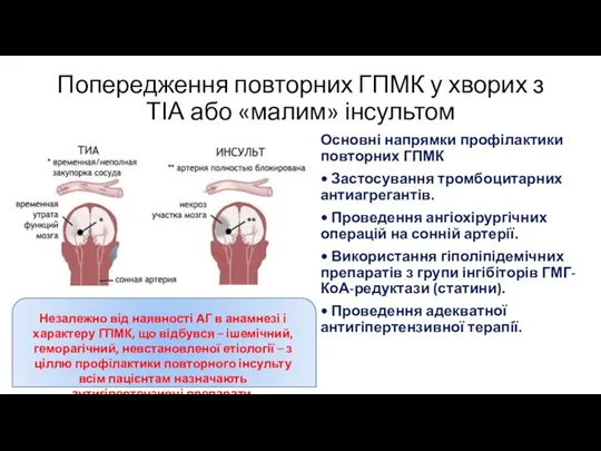 Попередження повторних ГПМК у хворих з ТІА або «малим» інсультом