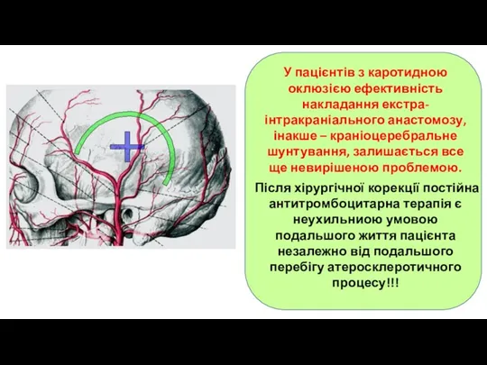 У пацієнтів з каротидною оклюзією ефективність накладання екстра-інтракраніального анастомозу, інакше