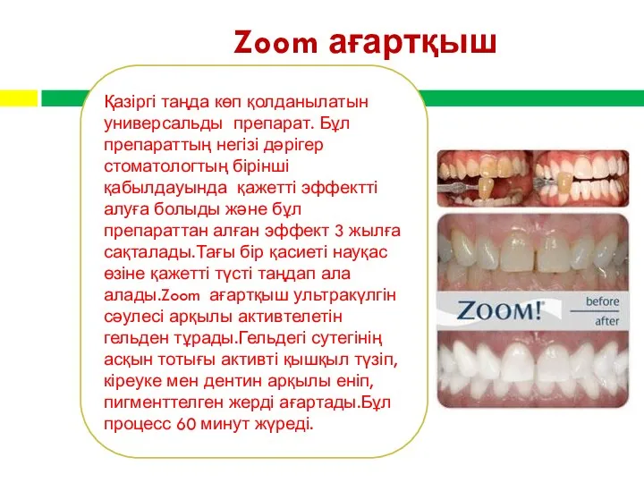 Zoom ағартқыш Қазіргі таңда көп қолданылатын универсальды препарат. Бұл препараттың