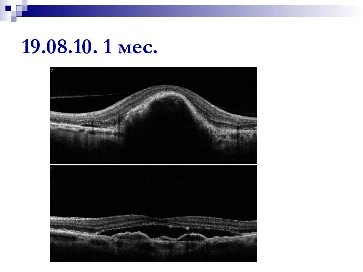 19.08.10. 1 мес.