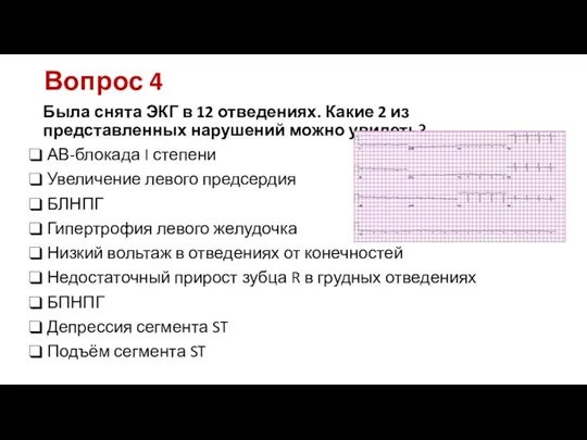 Вопрос 4 Была снята ЭКГ в 12 отведениях. Какие 2