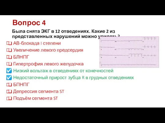 Вопрос 4 Была снята ЭКГ в 12 отведениях. Какие 2