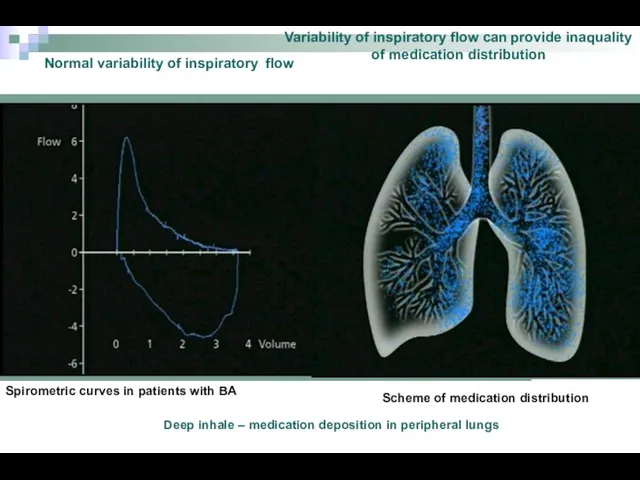 Normal variability of inspiratory flow Variability of inspiratory flow can provide inaquality of