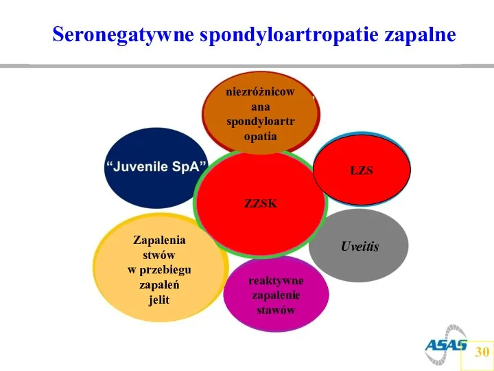 ZZSK niezróżnicowana spondyloartropatia ŁZS Uveitis reaktywne zapalenie stawów Zapalenia stwów