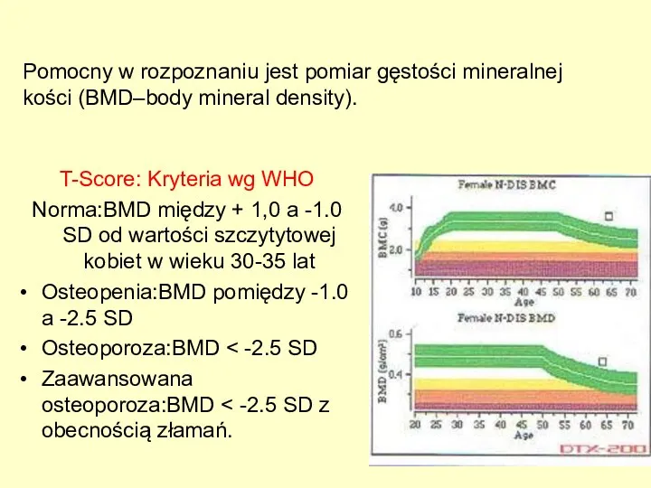 Pomocny w rozpoznaniu jest pomiar gęstości mineralnej kości (BMD–body mineral