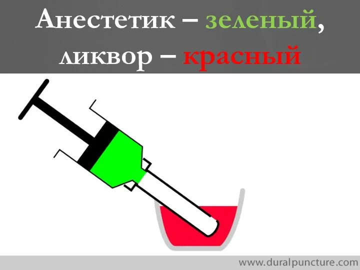 Анестетик – зеленый, ликвор – красный