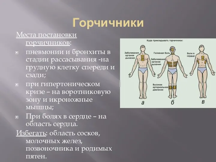 Горчичники Места постановки горчичников: пневмонии и бронхиты в стадии рассасывания -на грудную клетку