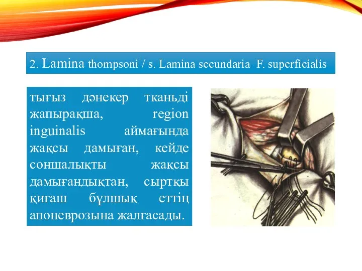 2. Lamina thompsoni / s. Lamina secundaria F. superficialis тығыз