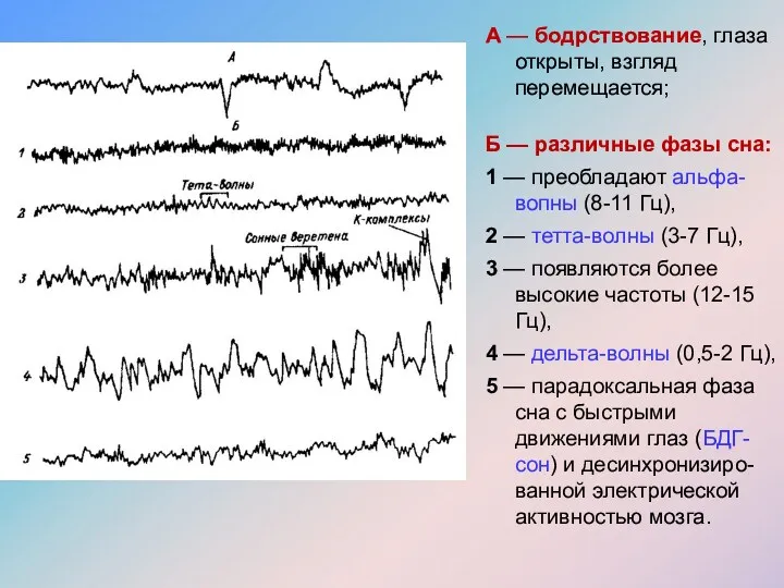 А — бодрствование, глаза открыты, взгляд перемещается; Б — различные