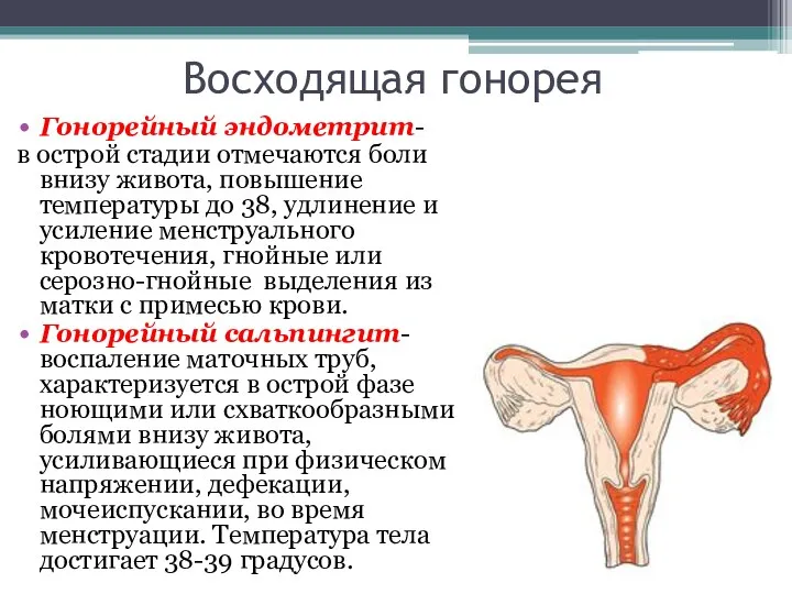 Восходящая гонорея Гонорейный эндометрит- в острой стадии отмечаются боли внизу