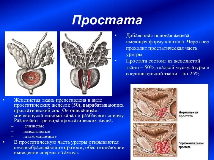 Простата Железистая ткань представлена в виде простатических железок (50), вырабатывающих