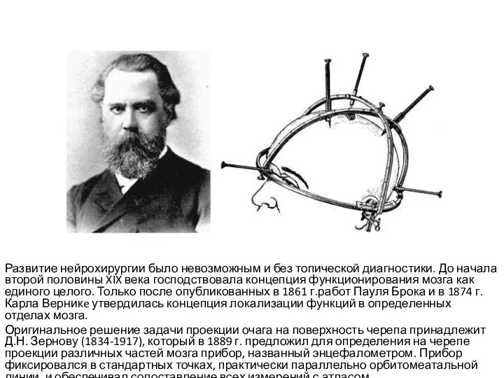 Развитие нейрохирургии было невозможным и без топической диагностики. До начала