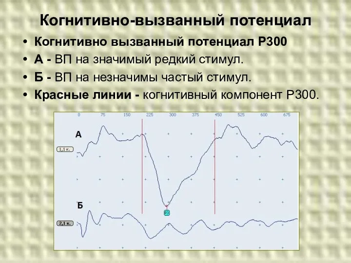 Когнитивно-вызванный потенциал Когнитивно вызванный потенциал Р300 А - ВП на