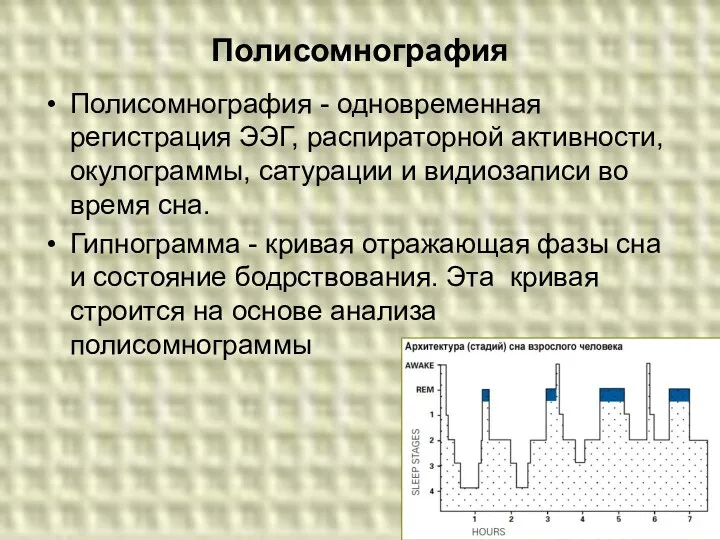 Полисомнография Полисомнография - одновременная регистрация ЭЭГ, распираторной активности, окулограммы, сатурации