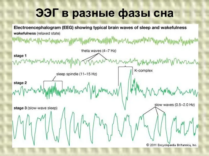 ЭЭГ в разные фазы сна