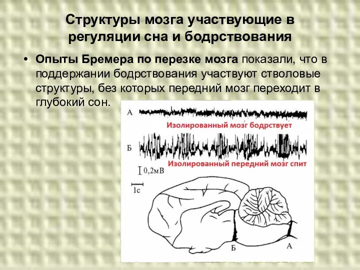 Структуры мозга участвующие в регуляции сна и бодрствования Опыты Бремера