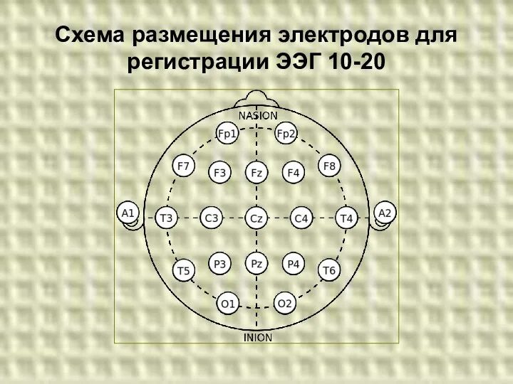 Схема размещения электродов для регистрации ЭЭГ 10-20