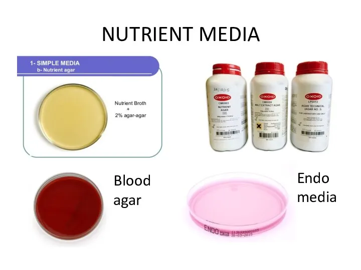 NUTRIENT MEDIA Blood agar Endo media