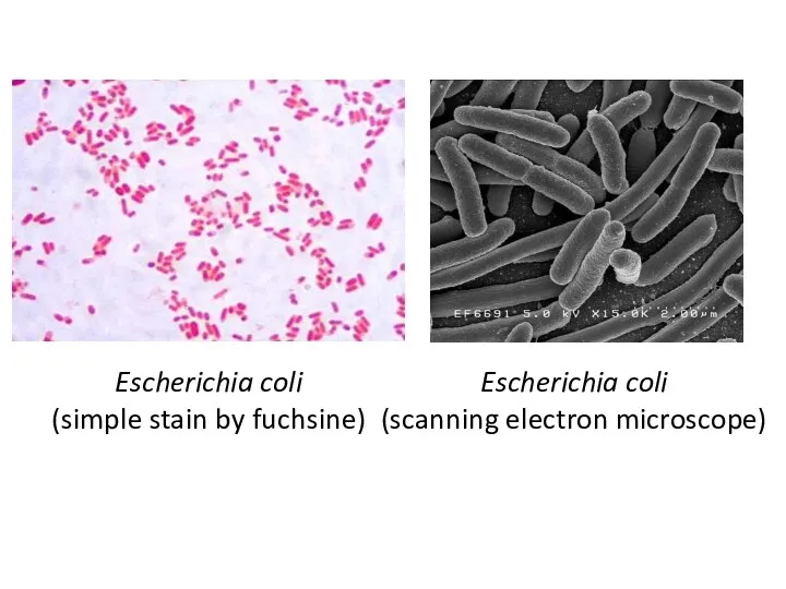 Escherichia coli (simple stain by fuchsine) Escherichia coli (scanning electron microscope)