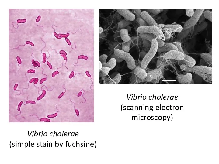 Vibrio cholerae (simple stain by fuchsine) Vibrio cholerae (scanning electron microscopy)