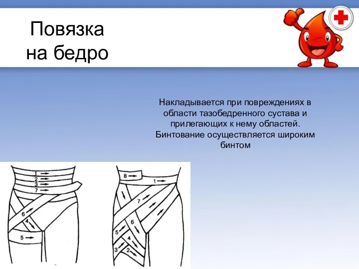 Повязка на бедро Накладывается при повреждениях в области тазобедренного сустава