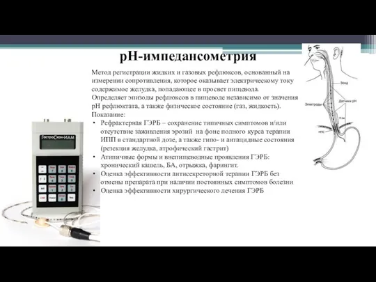 рН-импедансометрия Метод регистрации жидких и газовых рефлюксов, основанный на измерении