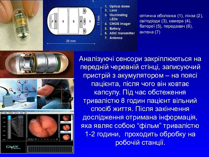 Аналізуючі сенсори закріплюються на передній черевній стінці, записуючий пристрій з