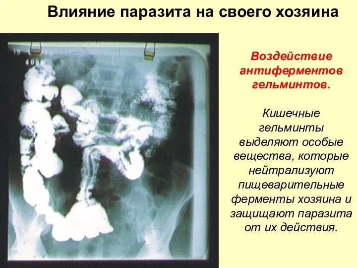 Воздействие антиферментов гельминтов. Кишечные гельминты выделяют особые вещества, которые нейтрализуют