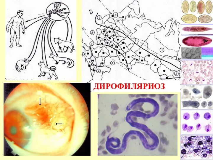 ДИРОФИЛЯРИОЗ