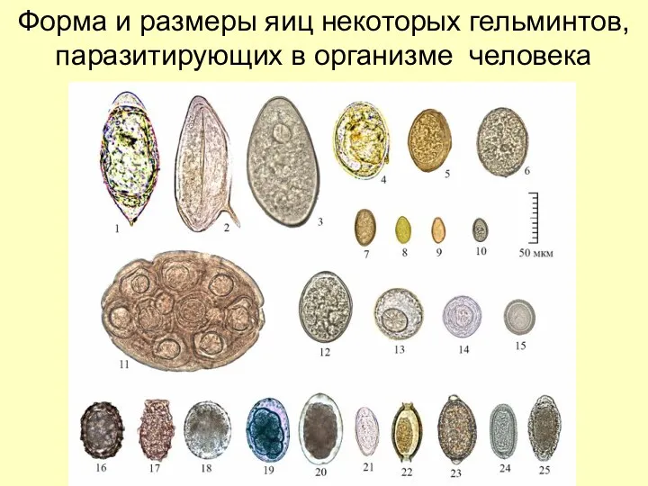 Форма и размеры яиц некоторых гельминтов, паразитирующих в организме человека
