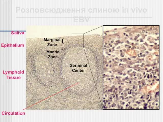 Germinal Center Mantle Zone Розповсюдження слиною іn vivo EBV Marginal Zone { Epithelium