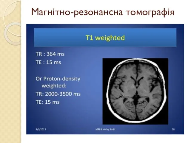 Магнітно-резонансна томографія