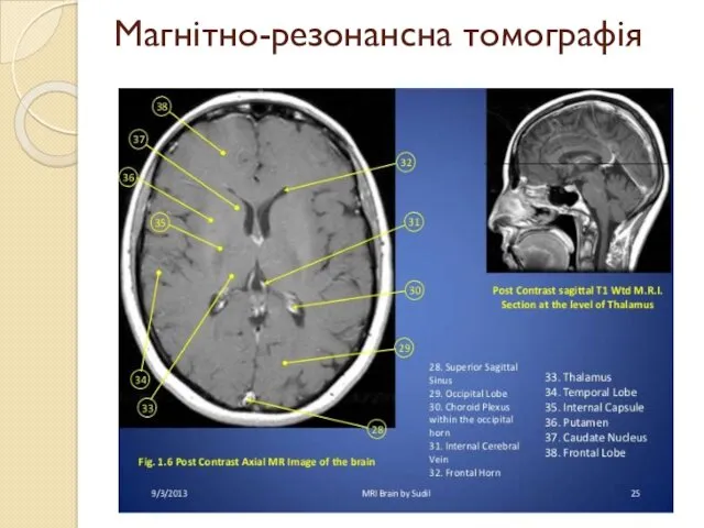 Магнітно-резонансна томографія