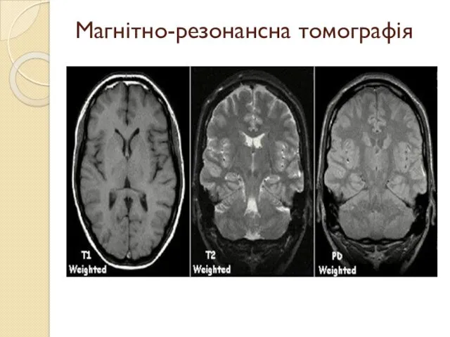 Магнітно-резонансна томографія