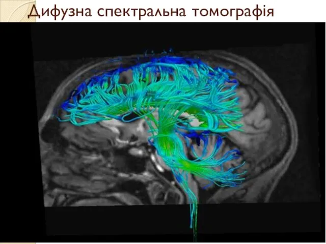 Дифузна спектральна томографія