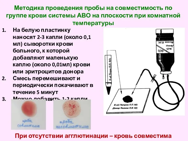 Методика проведения пробы на совместимость по группе крови системы АВО
