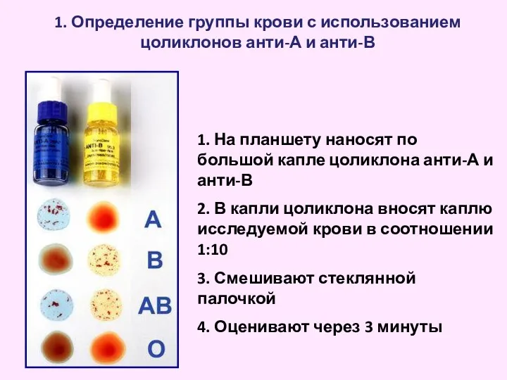 1. Определение группы крови с использованием цоликлонов анти-А и анти-В